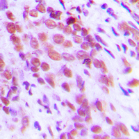 19 - Anti-NF-kappaB p65 (Phospho-S276) Antibody AP59688