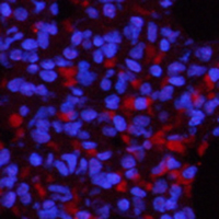 3 - Anti-NF-kappaB p65 (Phospho-S536) Antibody AP59689