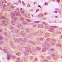 19 - Anti-NF-kappaB p65 (Phospho-S536) Antibody AP59689