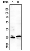 1 - Anti-RGS1 Antibody AP59690