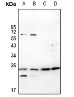 1 - Anti-RGS10 Antibody AP59691