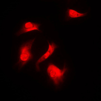 3 - Anti-S6K1 (Phospho-S418) Antibody AP59692