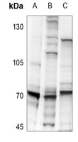 1 - Anti-S6K1 (Phospho-S418) Antibody AP59692
