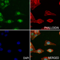 3 - Anti-S6K1 (Phospho-T421) Antibody AP59693