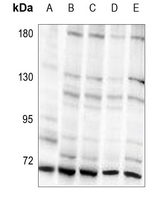 1 - Anti-S6K1 (Phospho-T421) Antibody AP59693