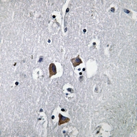 19 - Anti-CXCL12 Antibody AP59695