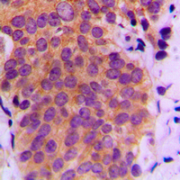 19 - Anti-MKK4 (Phospho-S80) Antibody AP59696