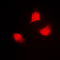 3 - Anti-MKK4 (Phospho-T261) Antibody AP59697