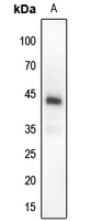 1 - Anti-MKK4 (Phospho-T261) Antibody AP59697