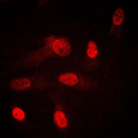3 - Anti-SGK1/2 Antibody AP59698