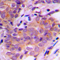 19 - Anti-SGK1/2 Antibody AP59698