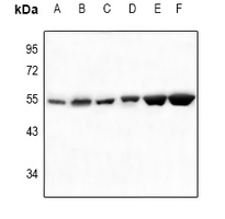 1 - Anti-SGK1/2 Antibody AP59698