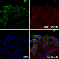 3 - Anti-SHB (Phospho-Y246) Antibody AP59699