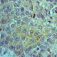19 - Anti-PEPT1 Antibody AP59700