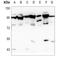 1 - Anti-OATP1 Antibody AP59701