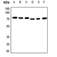 1 - Anti-SLC22A3 Antibody AP59702