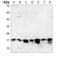 1 - Anti-SUMO2/3 Antibody AP59703