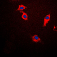 3 - Anti-Beta-synuclein Antibody AP59704