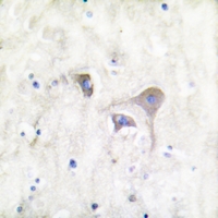 19 - Anti-Beta-synuclein Antibody AP59704