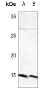 1 - Anti-Beta-synuclein Antibody AP59704