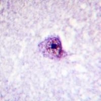 19 - Anti-SOX9 (Phospho-S181) Antibody AP59706