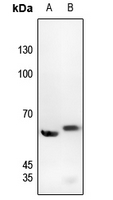 1 - Anti-c-SRC (Phospho-Y529) Antibody AP59707