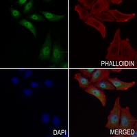 3 - Anti-STAT3 (Phospho-S727) Antibody AP59709