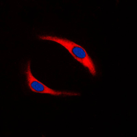 3 - Anti-SYK (Phospho-Y323) Antibody AP59711