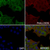 3 - Anti-SYK (Phospho-Y348) Antibody AP59712