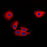3 - Anti-TIMP2 Antibody AP59717