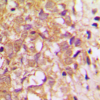 19 - Anti-TIMP2 Antibody AP59717