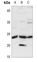 1 - Anti-TIMP2 Antibody AP59717