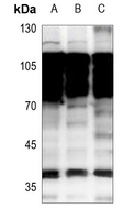 1 - Anti-NKX2-1 Antibody AP59718