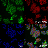 3 - Anti-cTnT Antibody AP59721