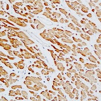 19 - Anti-cTnT Antibody AP59721