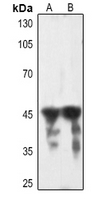 1 - Anti-cTnT Antibody AP59721