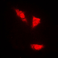 3 - Anti-p53 (Phospho-S15) Antibody AP59722