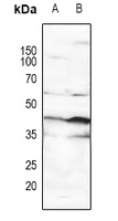 1 - Anti-p53 (Phospho-S15) Antibody AP59722