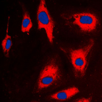 3 - Anti-TCTP Antibody AP59723