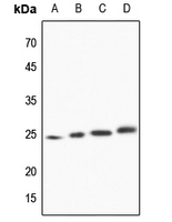 1 - Anti-TCTP Antibody AP59723