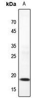 1 - Anti-UBC9 Antibody AP59724