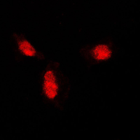 3 - Anti-SUMO1 Antibody AP59725