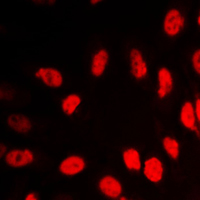 3 - Anti-VDR Antibody AP59729