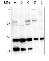 1 - Anti-VDR Antibody AP59729