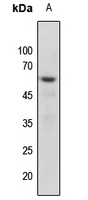 1 - Anti-Vimentin (Phospho-S56) Antibody AP59730