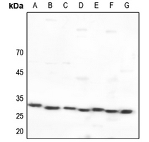 1 - Anti-14-3-3 epsilon Antibody AP59733