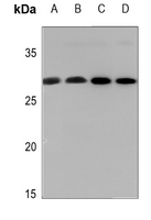 1 - Anti-14-3-3 zeta (Phospho-S58) Antibody AP59734