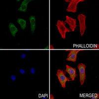 3 - Anti-ZNF227 Antibody AP59735