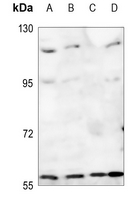 1 - Anti-Adracalin Antibody AP59736