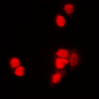 3 - Anti-Histone H3 (Acetyl-K9) Antibody AP59739